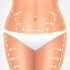 Everything About Liposuction Surgery