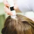 Scalp Treatments in Singapore to achieve your dream hair