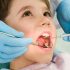 Wisdom Tooth Removal Singapore, Get The Best Treatment For Your Teeth